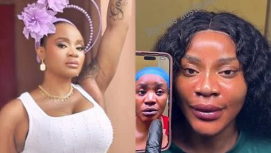 Uche Ogbodo Flaunts New Look After Facial Rejuvenation Procedure